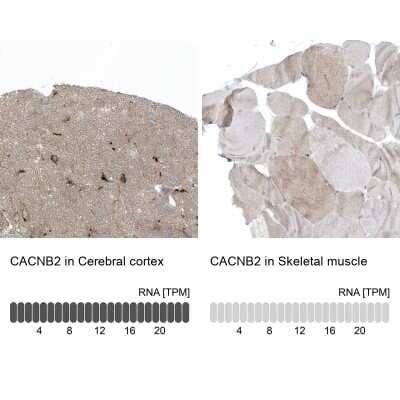 Immunohistochemistry-Paraffin: CACNB2 Antibody [NBP1-86680]