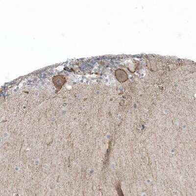 Immunohistochemistry-Paraffin: CACNB2 Antibody [NBP1-86680]