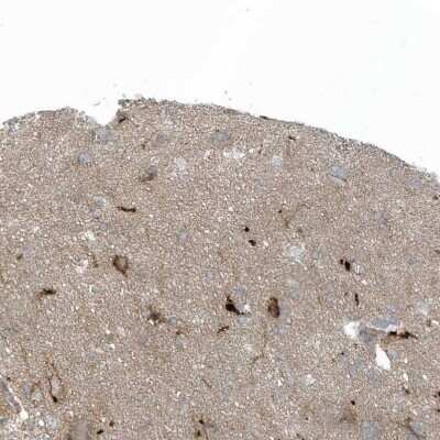 Immunohistochemistry-Paraffin: CACNB2 Antibody [NBP1-86680]