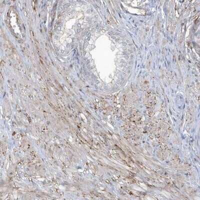 Immunohistochemistry-Paraffin: CACNB2 Antibody [NBP1-86680]