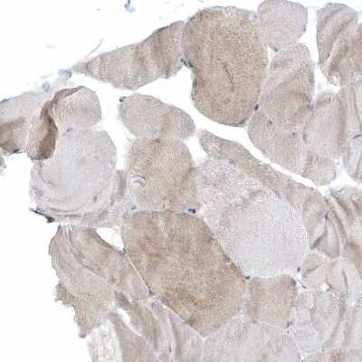 Immunohistochemistry-Paraffin: CACNB2 Antibody [NBP1-86680]