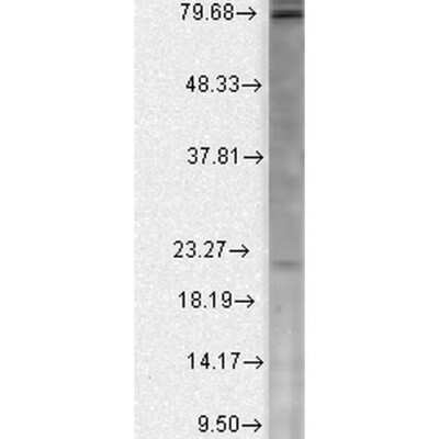 Western Blot: CACNB2 Antibody (N8b/1) [NBP1-47607]