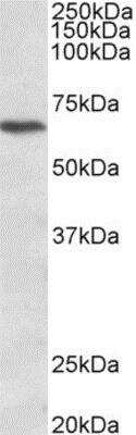 Western Blot: CACNB2 Antibody [NBP2-11566]