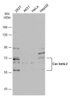 Western Blot: CACNB2 Antibody [NBP3-13049]