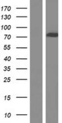 Western Blot: CACNB2 Overexpression Lysate [NBP2-08999]