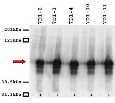 Western Blot: CACNB3 Antibody (7D1) [NBP3-13514]