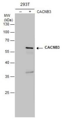 Western Blot: CACNB3 Antibody (7D1) [NBP3-13514]