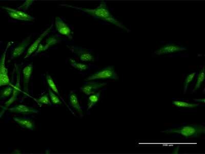 Immunocytochemistry/ Immunofluorescence: CACNB3 Antibody [H00000784-D01P]