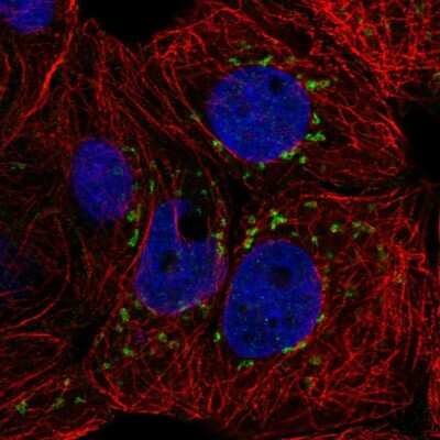 Immunocytochemistry/ Immunofluorescence: CACNB3 Antibody [NBP2-56436]