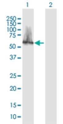 Western Blot: CACNB3 Antibody [H00000784-B01P]