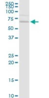 Western Blot: CACNB3 Antibody [H00000784-D01P]