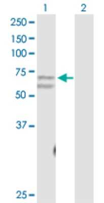 Western Blot: CACNB3 Antibody [H00000784-D01P]