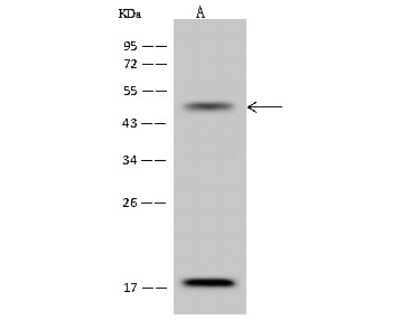 Western Blot: CACNB3 Antibody [NBP2-99461]