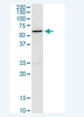 Western Blot: CACNB4 Antibody (7E1) [H00000785-M01-100ug]