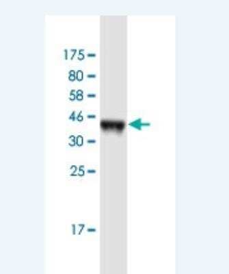 Western Blot: CACNB4 Antibody (7E1) [H00000785-M01-100ug]