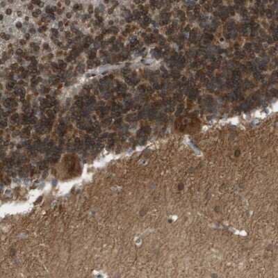 Immunohistochemistry-Paraffin: CACNB4 Antibody [NBP1-83984]