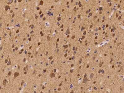 Immunohistochemistry-Paraffin: CACNB4 Antibody [NBP2-98196]