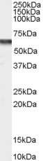 Western Blot: CACNB4 Antibody [NB100-55414]