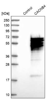 Western Blot: CACNB4 Antibody [NBP1-83984]