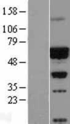 Western Blot: CACNB4 Overexpression Lysate [NBL1-08630]