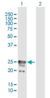Western Blot: CACNG1 Antibody [H00000786-B01P]