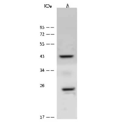 Western Blot: CACNG1 Antibody [NBP2-99567]