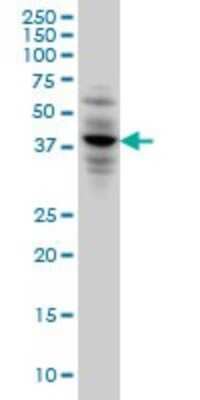 Western Blot: CACNG3 Antibody (3E4) [H00010368-M01]