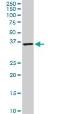 Western Blot: CACNG3 Antibody (3E4) [H00010368-M01]