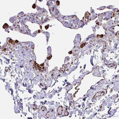 Immunohistochemistry-Paraffin: CACNG3 Antibody [NBP2-31738]