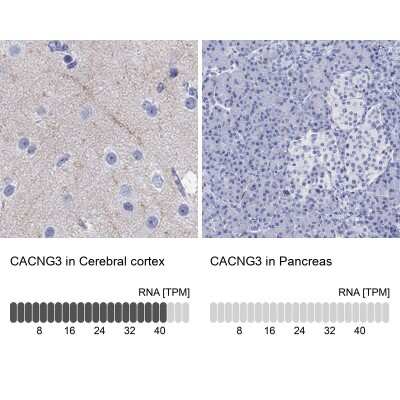 Immunohistochemistry-Paraffin: CACNG3 Antibody [NBP3-17047]