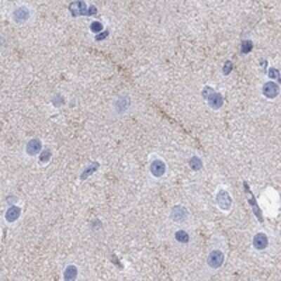 Immunohistochemistry-Paraffin: CACNG3 Antibody [NBP3-17047]