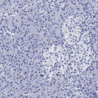 Immunohistochemistry-Paraffin: CACNG3 Antibody [NBP3-17047]