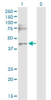 Western Blot: CACNG3 Antibody [H00010368-D01P]