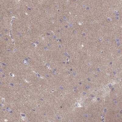 Immunohistochemistry-Paraffin: CACNG4 Antibody [NBP2-55176]