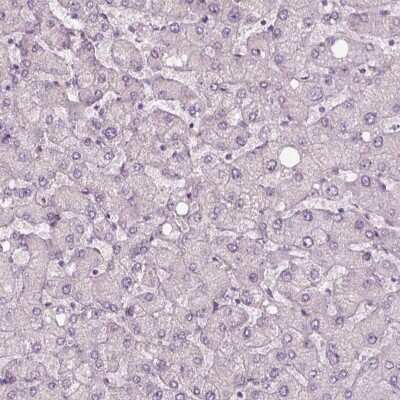 Immunohistochemistry-Paraffin: CACNG4 Antibody [NBP2-55176]