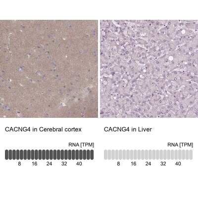 Immunohistochemistry-Paraffin: CACNG4 Antibody [NBP2-55176]