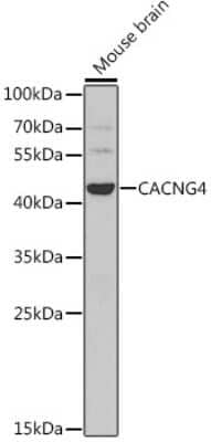 Immunohistochemistry-Paraffin: CACNG4 Antibody - BSA Free [NBP2-92675]