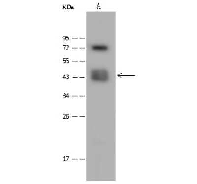 Western Blot: CACNG4 Antibody [NBP2-99568]