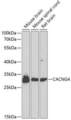 Western Blot: CACNG4 AntibodyBSA Free [NBP3-04844]