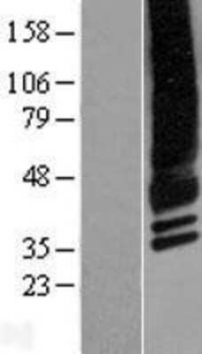 Western Blot: CACNG4 Overexpression Lysate [NBP2-07343]