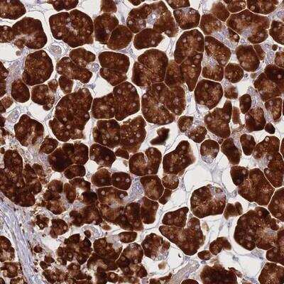 Immunohistochemistry-Paraffin: CACNG5 Antibody [NBP2-14432]