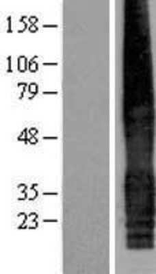 Western Blot: CACNG5 Overexpression Lysate [NBP2-05372]