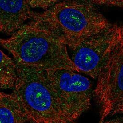 Immunocytochemistry/ Immunofluorescence: CACNG6 Antibody [NBP2-56816]