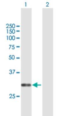 Western Blot: CACNG6 Antibody [H00059285-B01P]