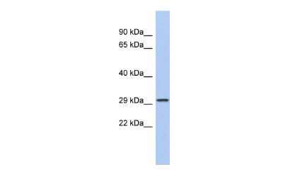 Western Blot: CACNG6 Antibody [NBP2-84578]