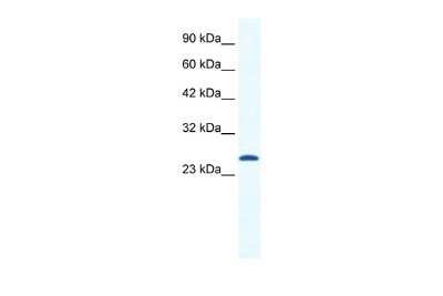 Western Blot: CACNG6 Antibody [NBP2-84579]