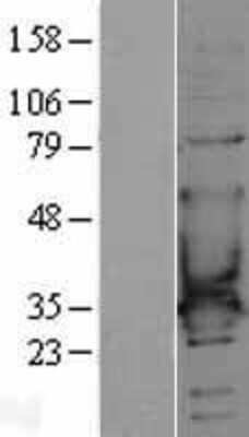 Western Blot: CACNG6 Overexpression Lysate [NBL1-08634]