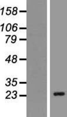 Western Blot: CACNG6 Overexpression Lysate [NBP2-05458]