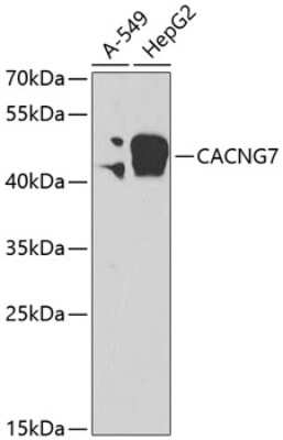 Western Blot: CACNG7 AntibodyBSA Free [NBP2-92528]