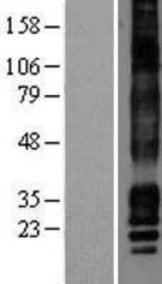 Western Blot: CACNG7 Overexpression Lysate [NBP2-04402]